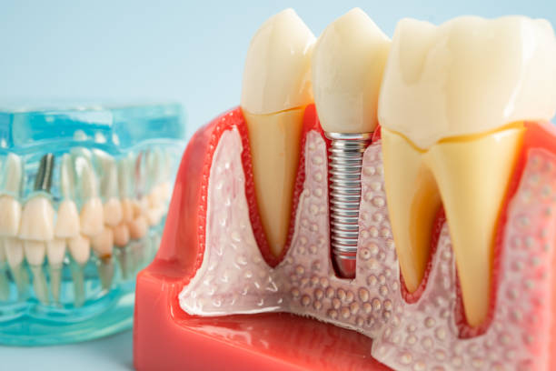 Oral Surgery in Dunlap, OH